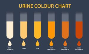 Urine Color chart